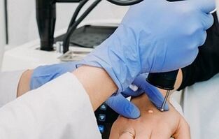 tüükade eemaldamise viisid